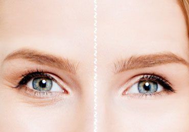 anti aging kiegészítők a ráncok ellen